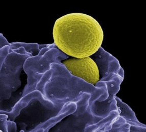 鼻腔内天然抗生素能杀灭“超级细菌”